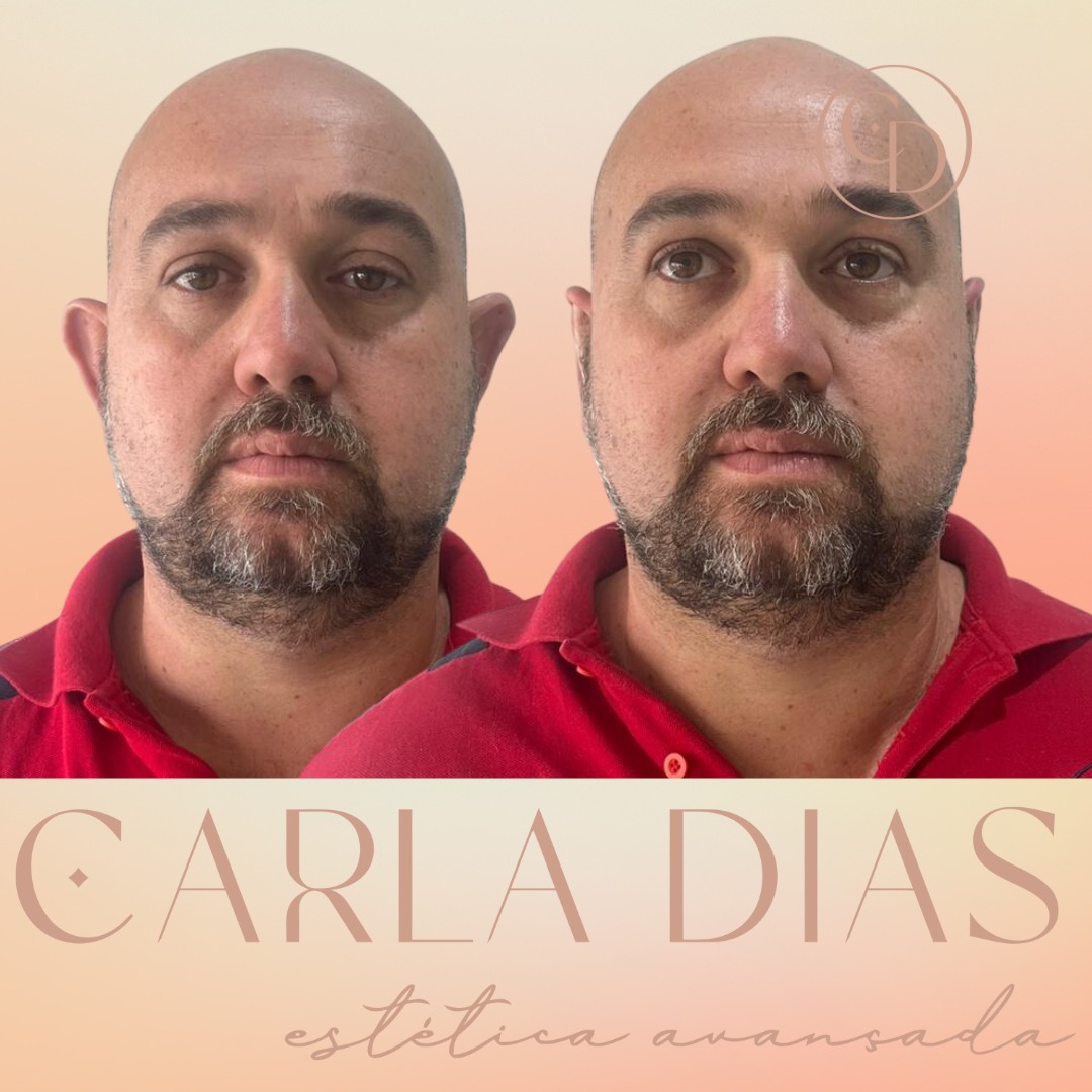 Antes e Depois 1