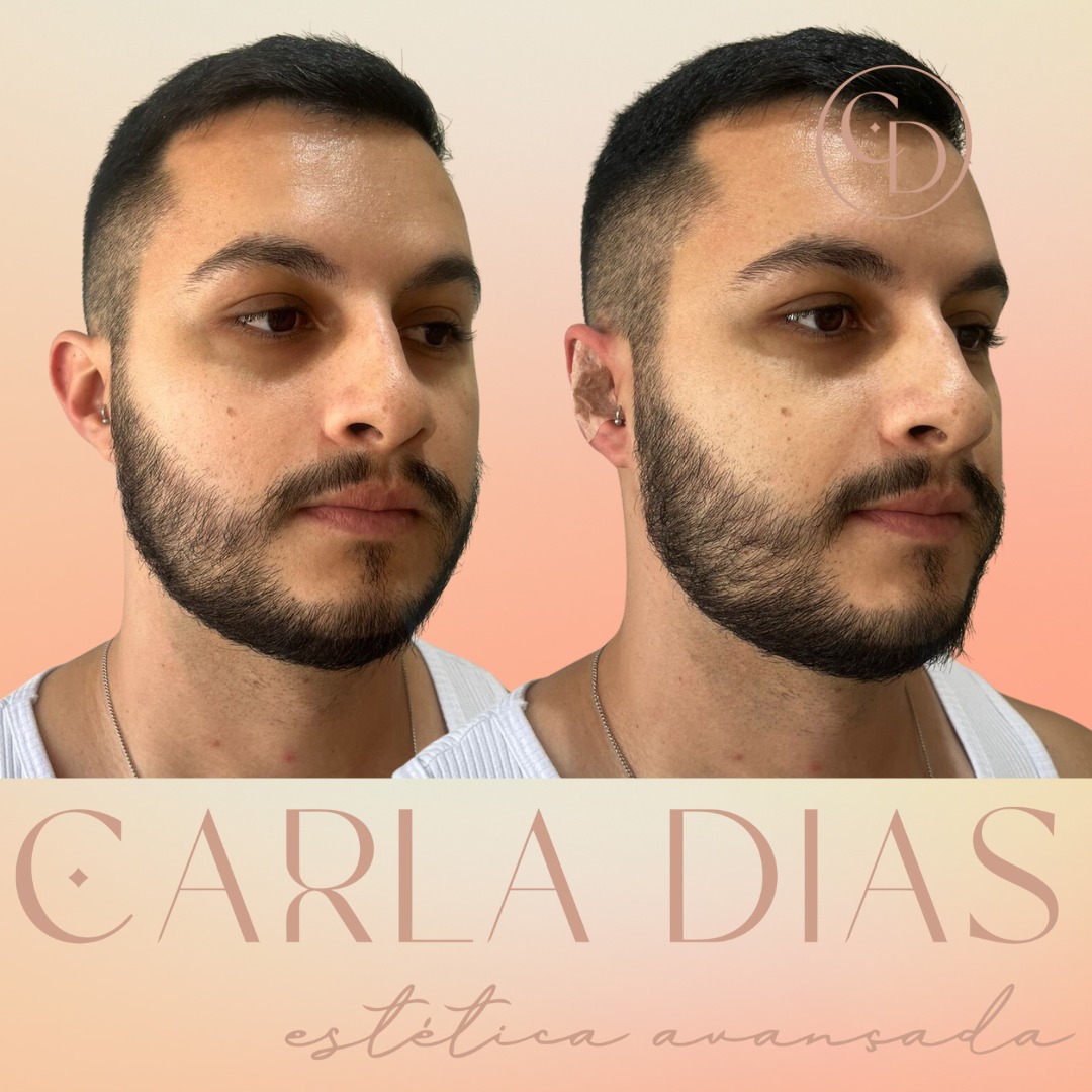 Antes e Depois 2