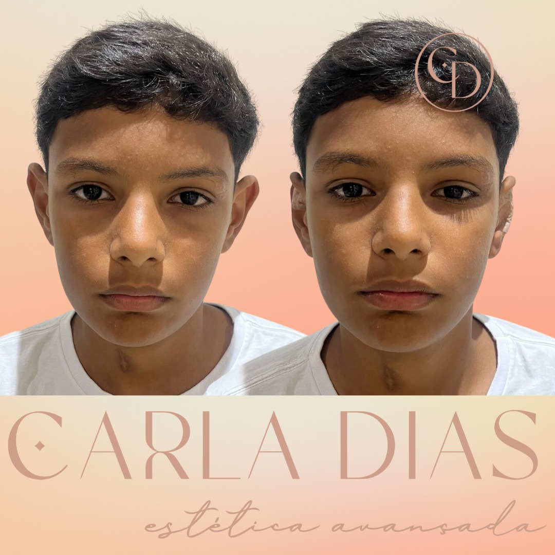 Antes e Depois 3
