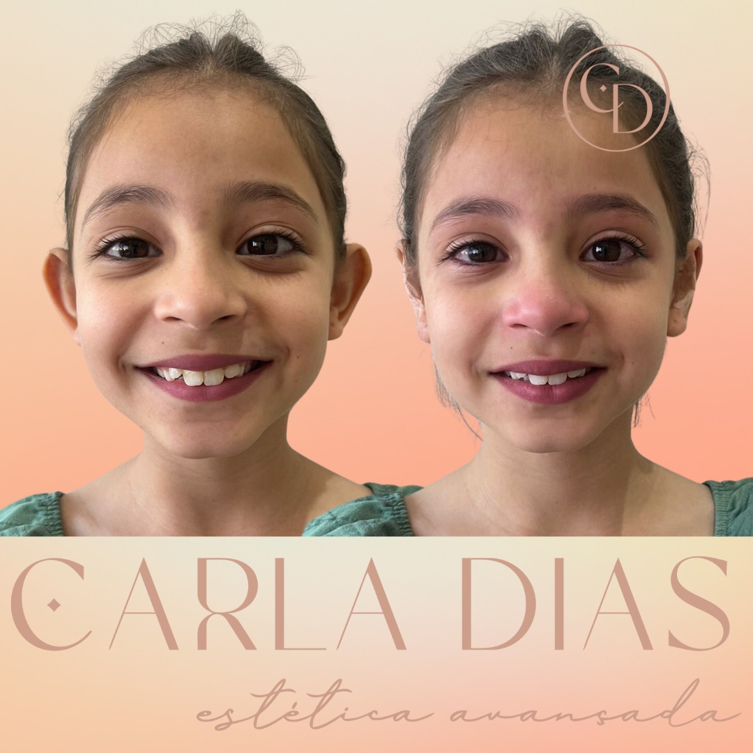 Antes e Depois 4
