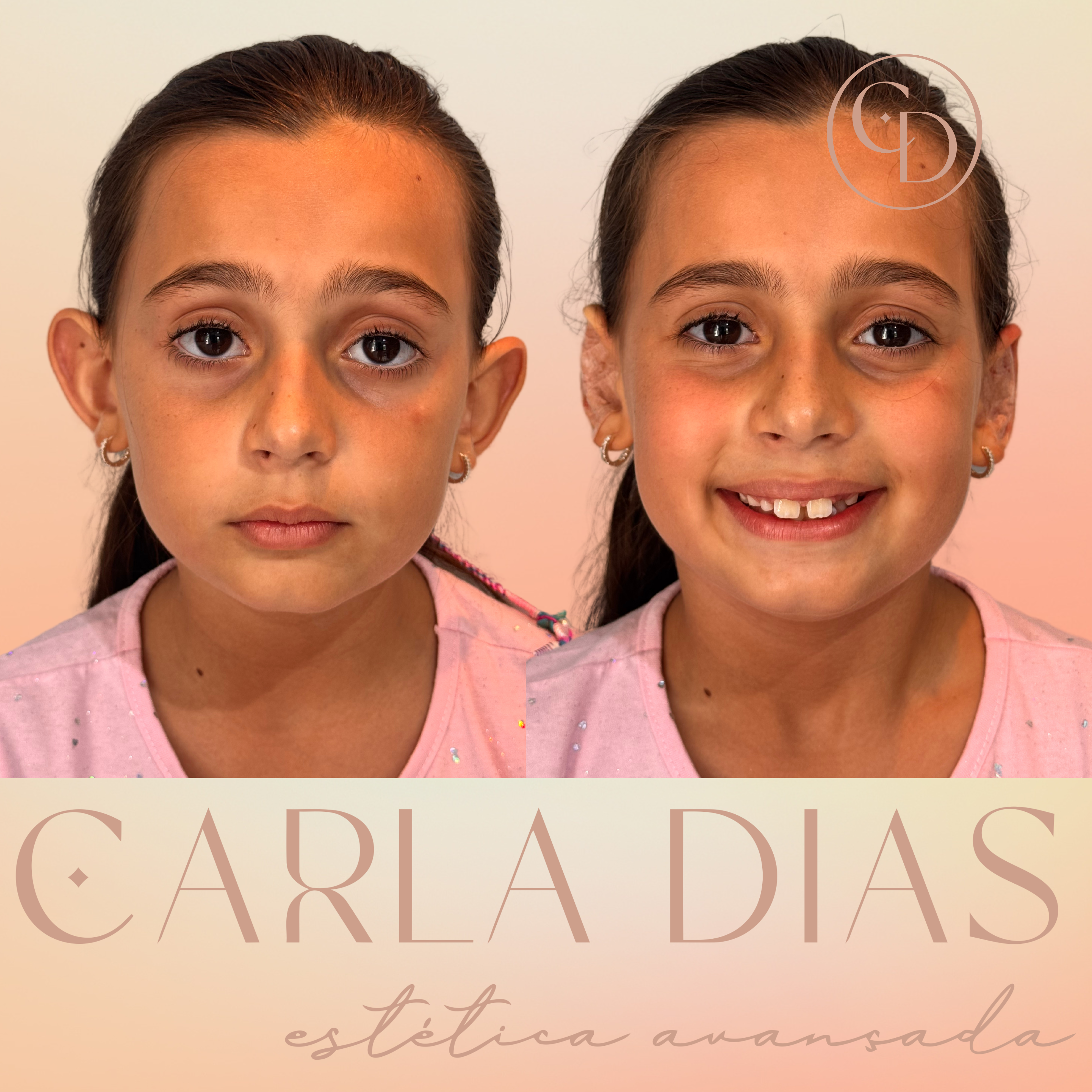 Antes e Depois 6