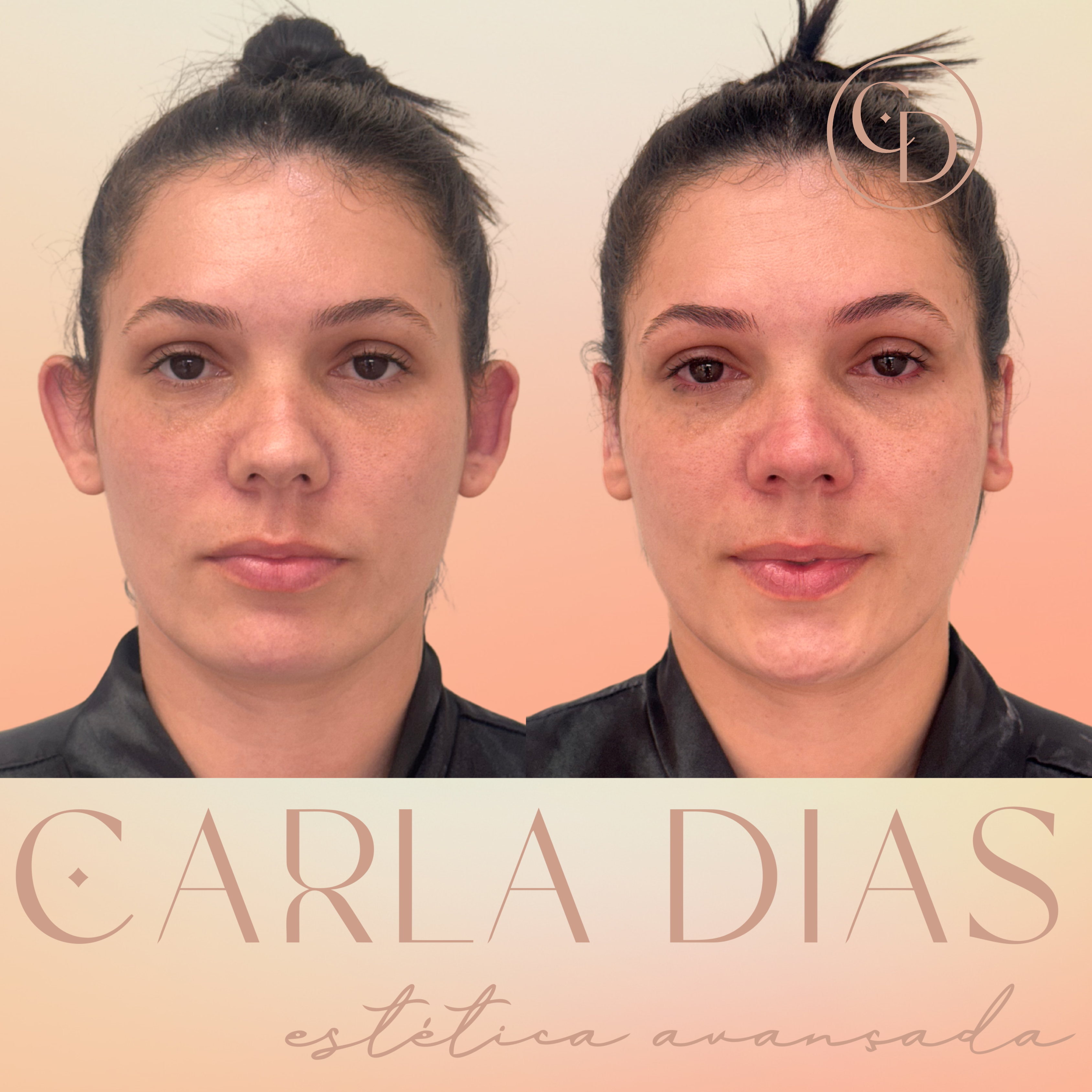 Antes e Depois 7