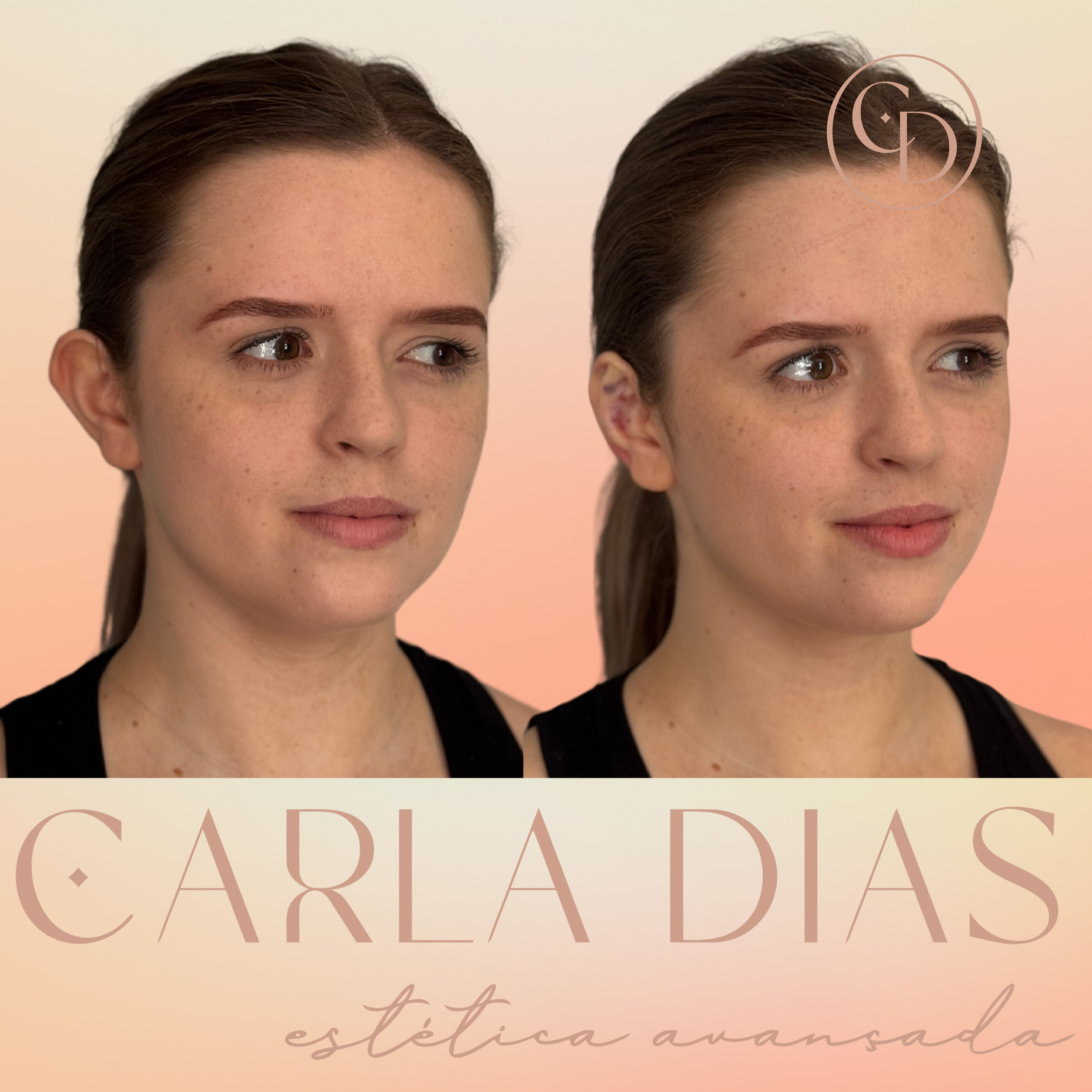 Antes e Depois 8