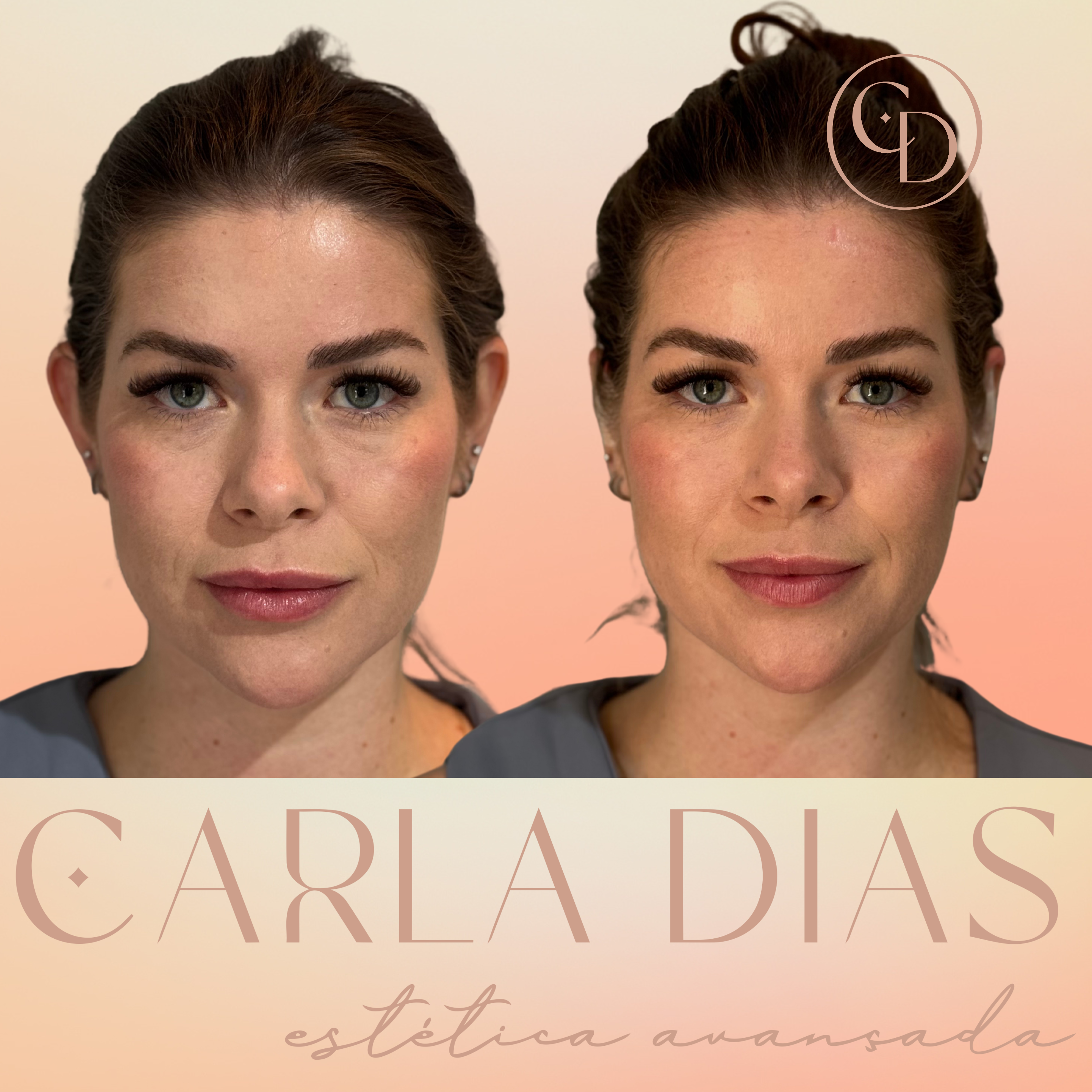 Antes e Depois 9